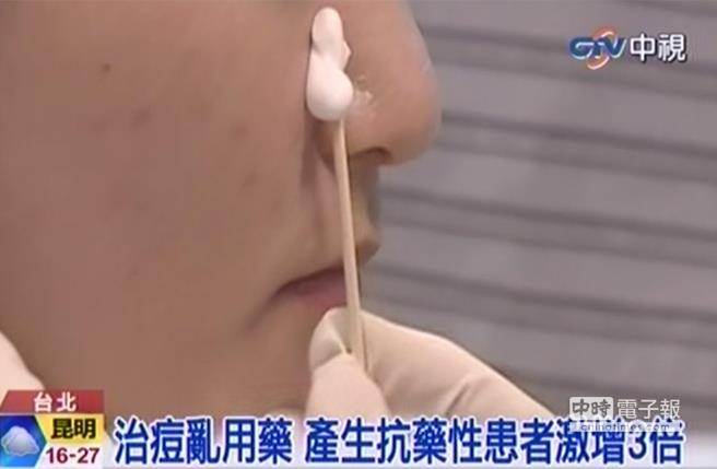 治痘小心抗藥性／圖截自中視新聞