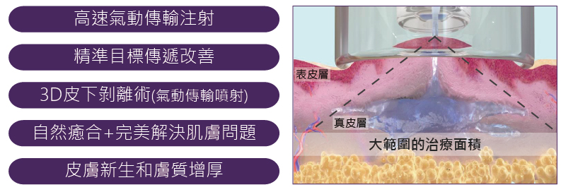JVR氣動脈衝 JVR氣動脈衝