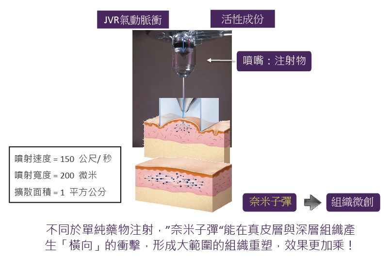 JVR氣動脈衝 JVR氣動脈衝