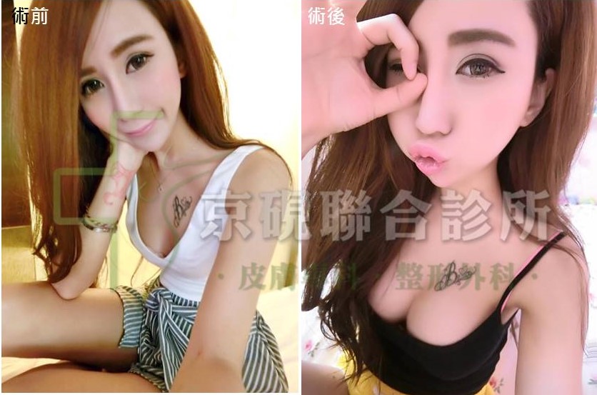 京硯整形外科, 京硯皮膚科, 京硯聯合診所, 張耀元, 蔡逸姍