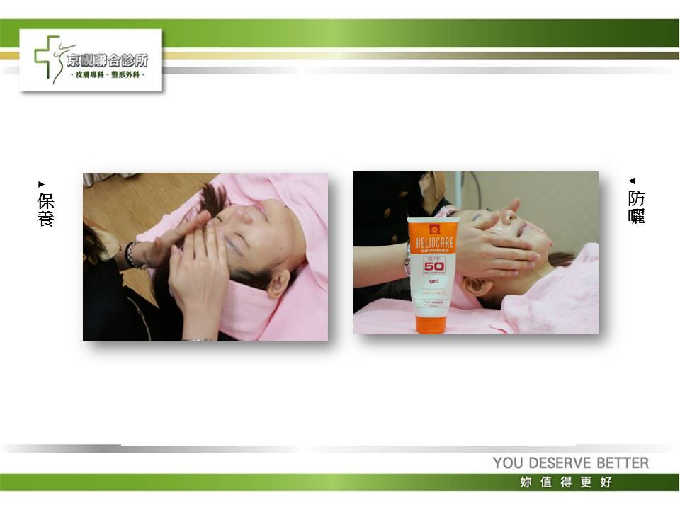 美容療程, 杏仁酸換膚, 去角質, 痘痘肌, 粉刺, 淡斑, 深層清潔, 京硯整形外科, 京硯皮膚科, 京硯聯合診所, 張耀元, 蔡逸姍